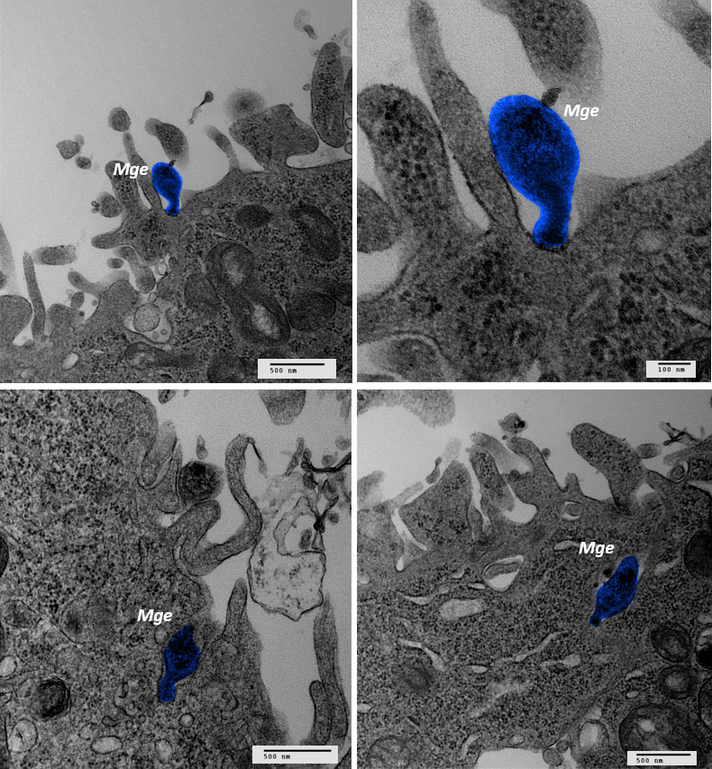 Imágenes de microscopia electrónica de transmisión, en las que se observa la bacteria Mycoplasma genitalium (Mge) adherida a la superficie de una célula humana (imágenes superiores) y penetrando en el interior (imágenes inferiores). La imagen ha sido editada para facilitar la identificación del micoplasma (coloreado en azul). 